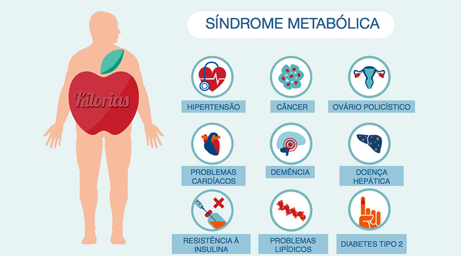 Sindrome Metabolica